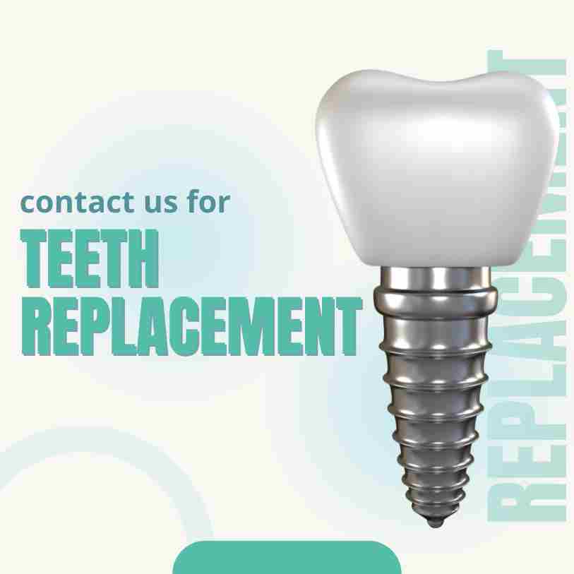 Teeth replacement procedures